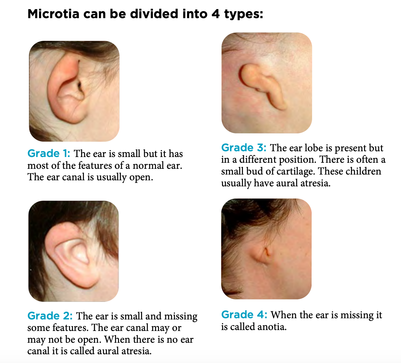 ear images